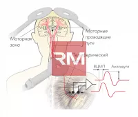 Транскраниальный магнитный стимулятор NEURO-MSX диагностический
 - 3