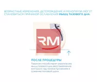 ЭЛЕКТРОМАГНИТНОЕ КРЕСЛО ДЛЯ УКРЕПЛЕНИЯ МЫШЦ ТАЗОВОГО ДНА BTL EMSELLA - 6