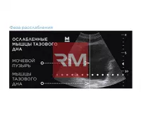 ЭЛЕКТРОМАГНИТНОЕ КРЕСЛО ДЛЯ УКРЕПЛЕНИЯ МЫШЦ ТАЗОВОГО ДНА BTL EMSELLA - 8