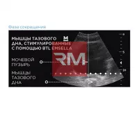 ЭЛЕКТРОМАГНИТНОЕ КРЕСЛО ДЛЯ УКРЕПЛЕНИЯ МЫШЦ ТАЗОВОГО ДНА BTL EMSELLA - 9
