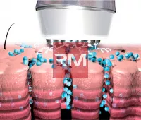 INFUSION — Аппарат для электромезотерапии - 5