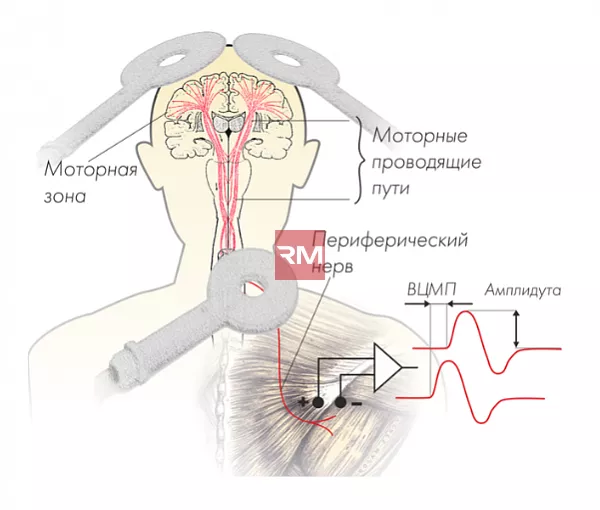 Транскраниальный магнитный стимулятор NEURO-MSX диагностический
 - 3