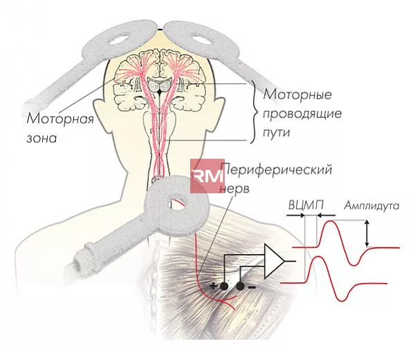 Аппарат транскраниальной магнитной стимуляции NEURO-MSX - 5
