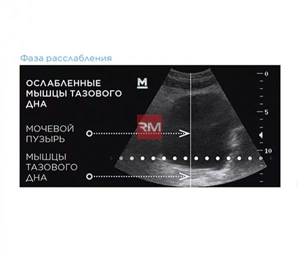 ЭЛЕКТРОМАГНИТНОЕ КРЕСЛО ДЛЯ УКРЕПЛЕНИЯ МЫШЦ ТАЗОВОГО ДНА BTL EMSELLA - 8