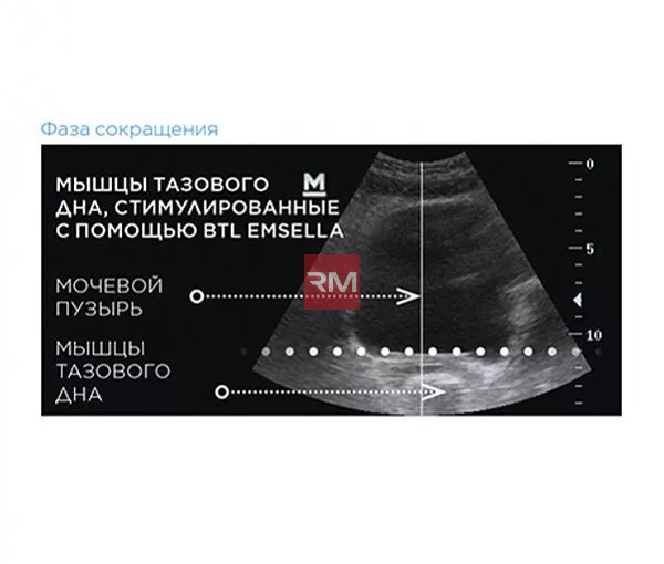 ЭЛЕКТРОМАГНИТНОЕ КРЕСЛО ДЛЯ УКРЕПЛЕНИЯ МЫШЦ ТАЗОВОГО ДНА BTL EMSELLA - 9